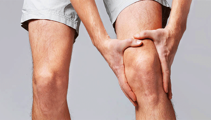 جراحی زانوی ضربدری یا ایکس چیست؟