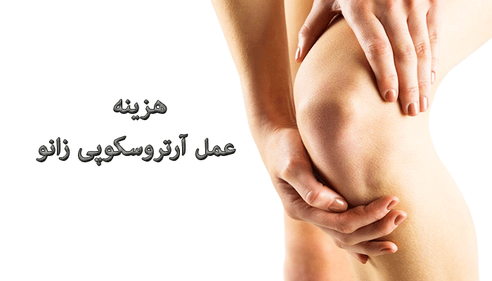 زینه عمل آرتروسکوپی زانو چقدر است؟
