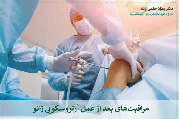 مراقبتهای بعد از عمل آرتروسکوپی زانو