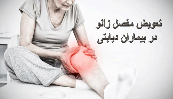 تعویض مفصل زانو در بیماران دیابتی چگونه است؟