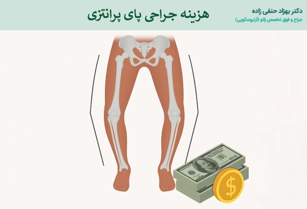 هزینه جراحی پای پرانتزی