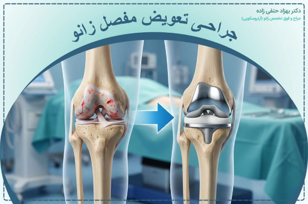 جراحی تعویض مفصل زانو