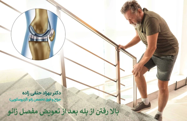 بالا رفتن از پله بعد از تعویض مفصل زانو