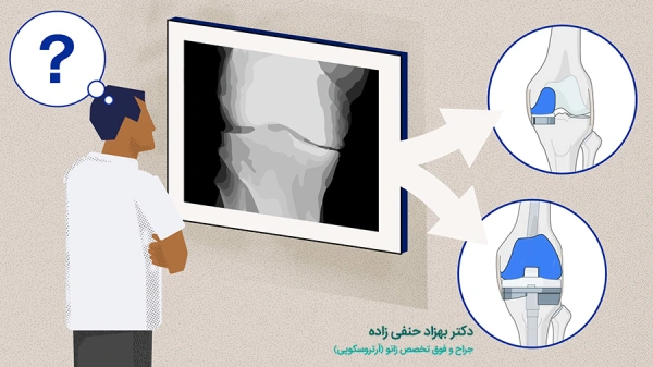 مزایای عمل تعویض مفصل نیمه زانو