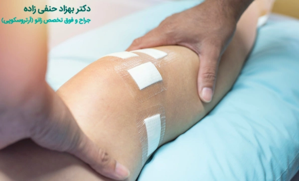 عوارض آرتروسکوپی زانو