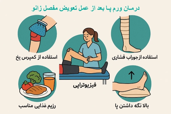 درمان ورم پا بعد از عمل تعویض مفصل زانو