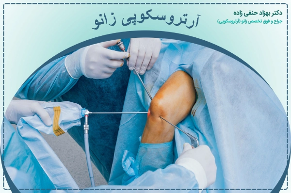 knee arthroscopy