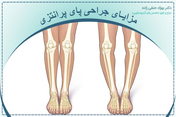 مزایای جراحی پای پرانتزی