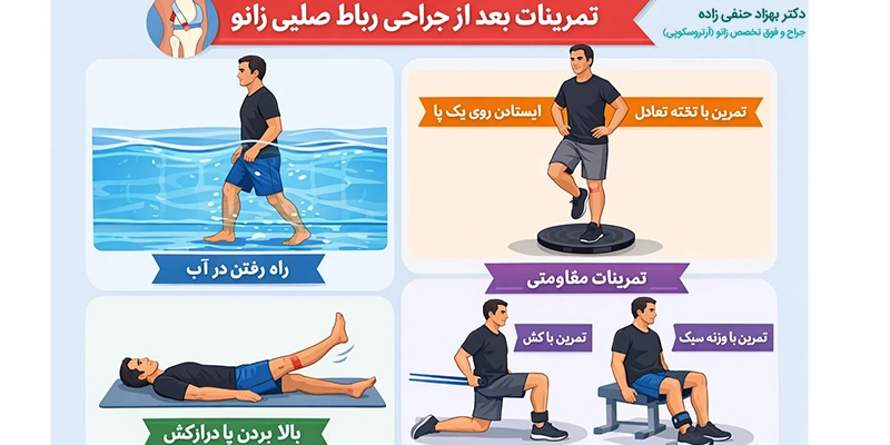 تمرینات تقویتی برای بهبود راه رفتن بعد از جراحی رباط صلیبی زانو